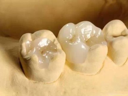 啥？机器人要给我看牙？AI堵牙到底是黑科技还是纯忽悠？