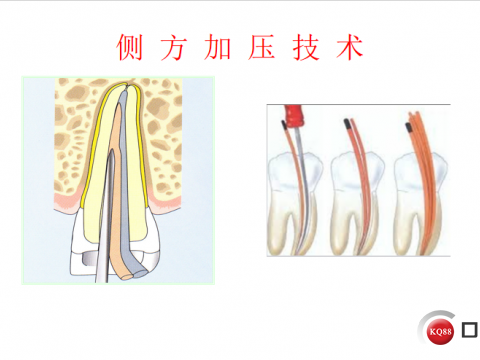 口腔常用技术全攻略与心得分享